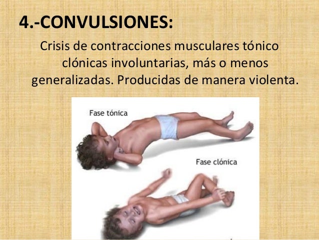 semiologia del sistema nervioso osvaldo fustinoni semiologia del sistema nervioso osvaldo fustinoni